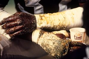 100 Greatest Photos - 046 - Lester Hayes